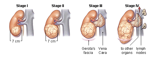 peeing Extreme urination pain blood during