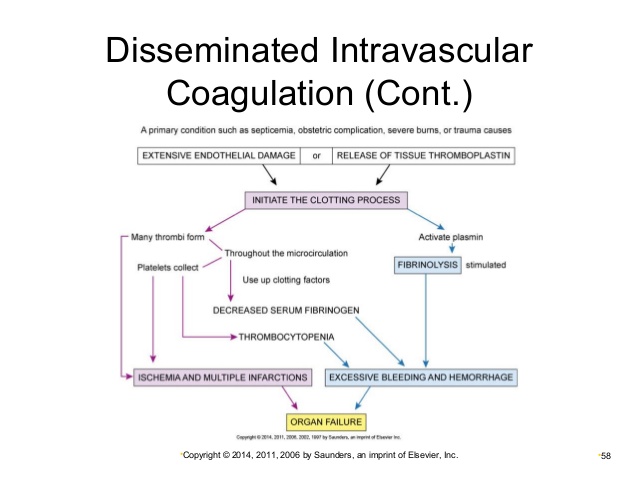 dic disseminated intravascular coagulation complication