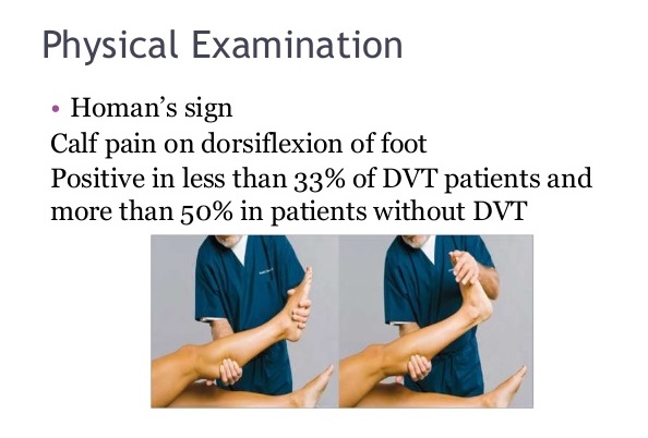 dvt deep vein thrombosis diagnosis