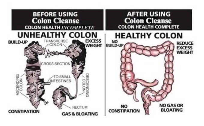 colon cleanse weight loss