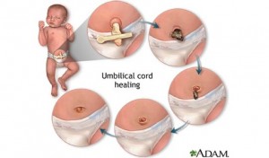 Umbilical Cord Bleeding Care