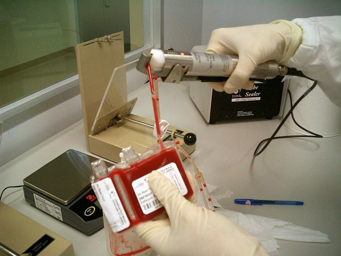 Umbilical Cord Blood Storage