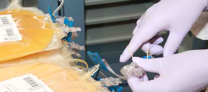 fresh frozen plasma