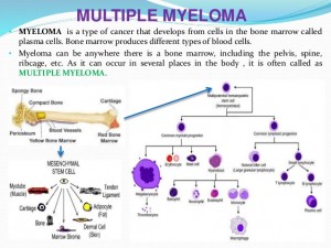 multiple myeloma survival rate