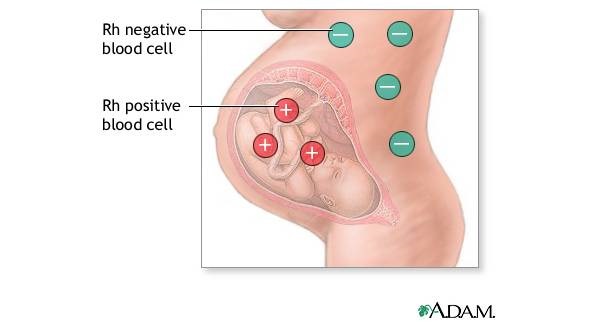 rh negative blood type