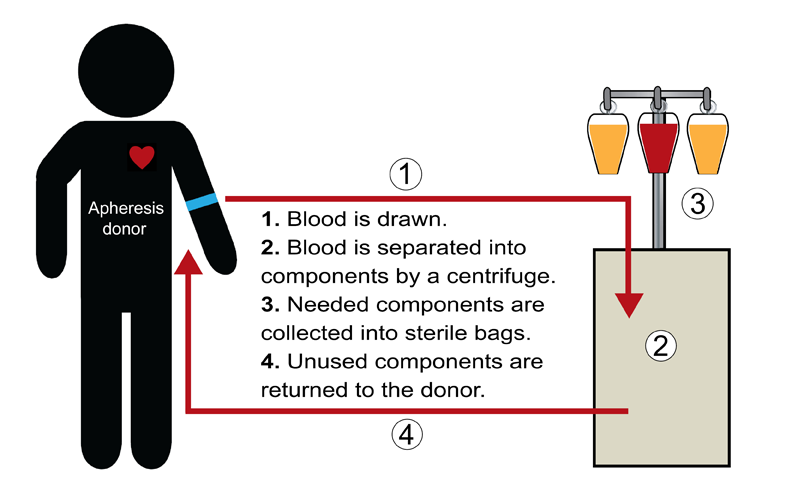 Apheresis Process